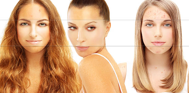 what is alpha arbutin used for